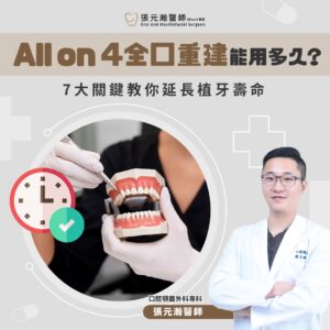 Read more about the article All on 4全口重建能用多久？7大關鍵教你延長植牙壽命＆成功案例分享