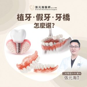 Read more about the article 缺牙風險不可不知！專業醫師解析植牙、假牙、牙橋怎麼選？